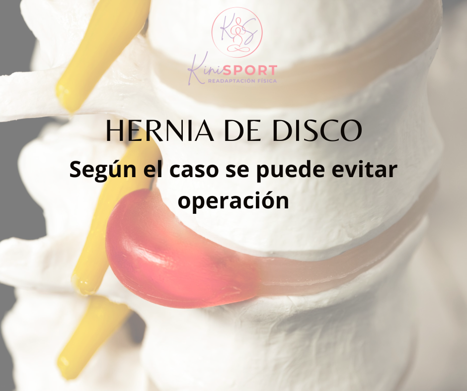 Fisioterapia de columna lumbar y cervical en Tijuana - hernia de disco, ciática